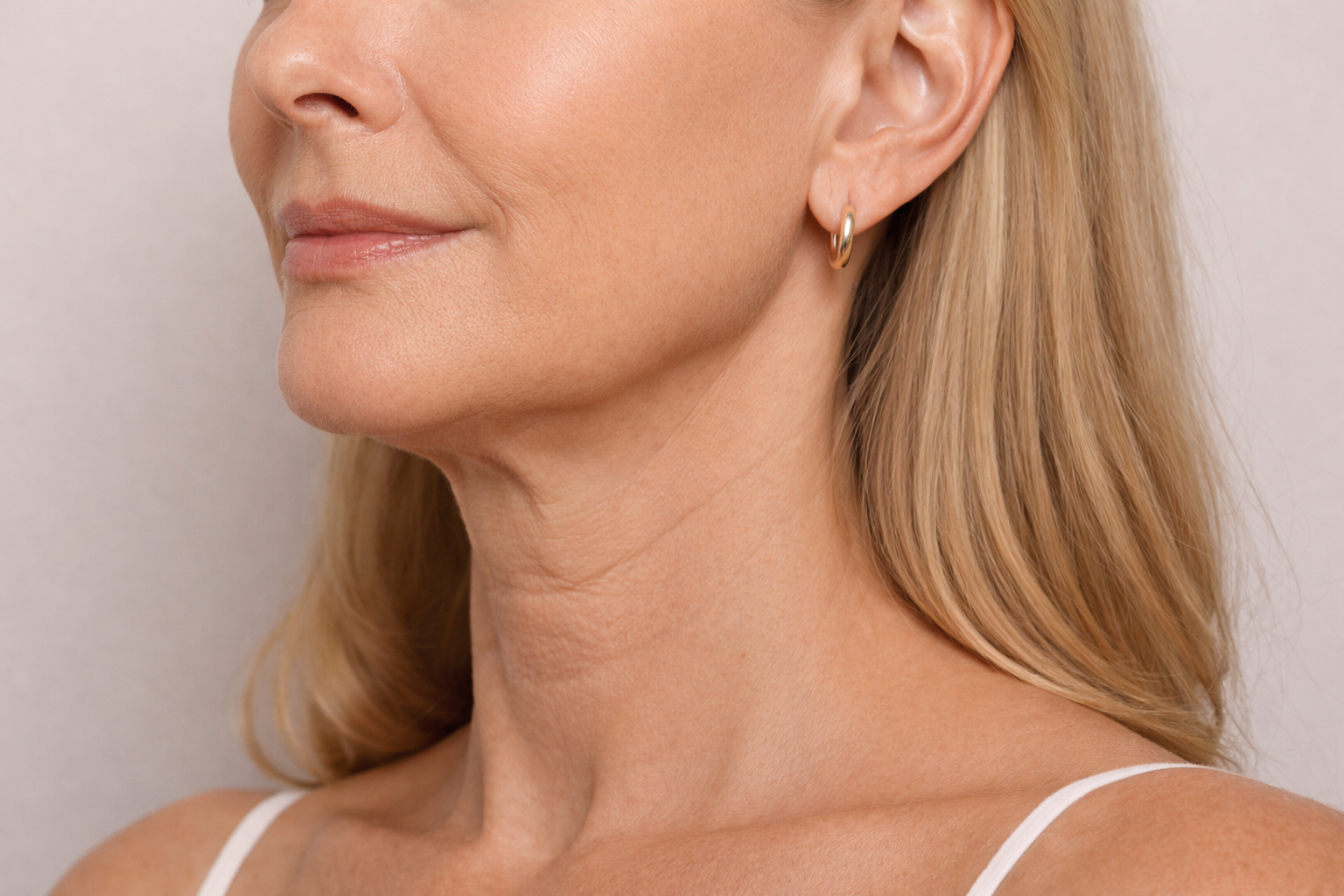 Before HIFU 7D face lift treatment at Hera Wellness Studio